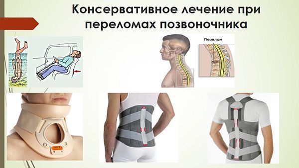 perelom pozvonochnika konservativnoe 1