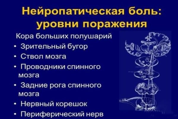 Нейропатичний біль 2 Нейропатическая боль